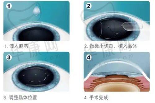 南昌华厦眼科医院的优势与保护