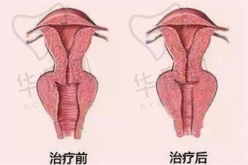 重庆美仑美奂整形美容医院在吸脂项目上的特色优势