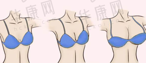 如何选择杭州靠谱的整形医院和双眼皮医生