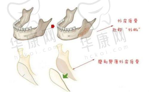 杭州美莱医疗美容医院做双眼皮靠谱吗？有哪些医生推荐