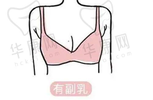 长沙美莱医疗美容医院吴蒙医生的口碑评价
