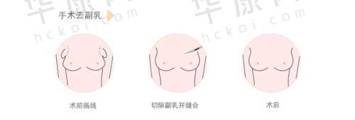 深圳悦尔医疗美容门诊部疤痕科如何预约挂号
