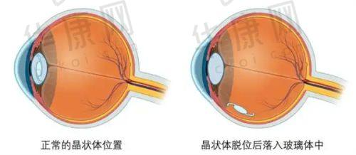 上海丽质医疗美容在O型腿矫正方面的特色优势