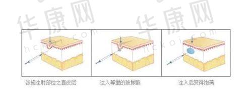 总结及建议