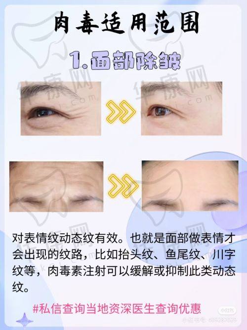 武汉五洲整形外科医院在半肋鼻综合项目上的特色