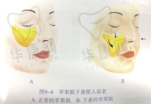 兰大一院整形科2025面部整形项目价格如何选择？