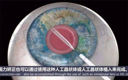 沧州爱尔眼科医院的地址与营业时间是怎样的？
