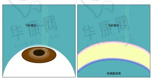 武汉德视佳眼科