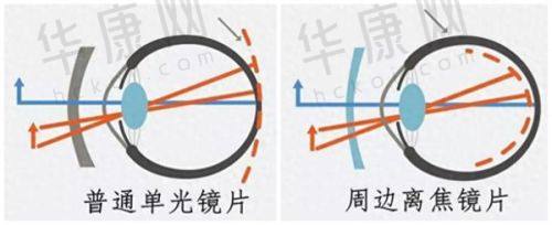 术后成效与感受