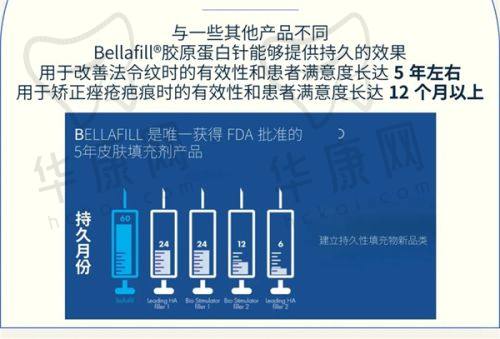 招风耳矫正的手术方式之软骨缝合法
