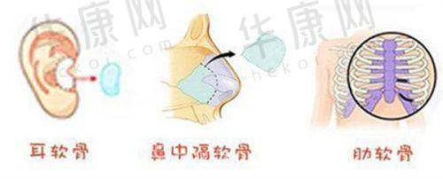 杨水斌半肋鼻综合的成功实例展示