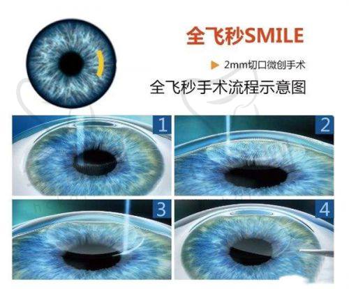 张建东医生擅长项目