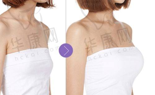 如何降低哺乳风险
