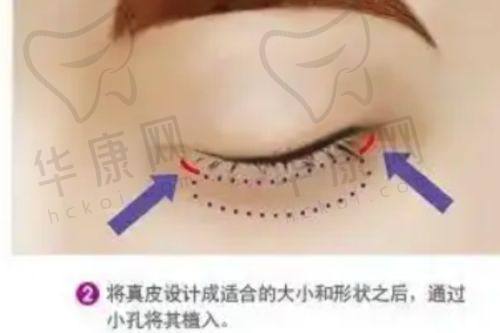 选择医院的建议