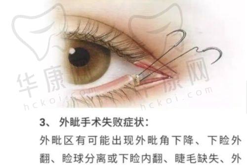 北京禾美嘉吸脂靠谱吗？技术规范吗？