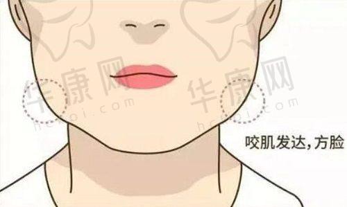 成都高新怡脂医疗美容刘芳医生特色技术优势