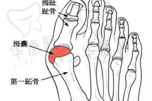 手术操作与留疤的关系