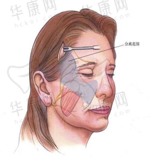 芜湖伊莱美隆胸吸脂怎么样？