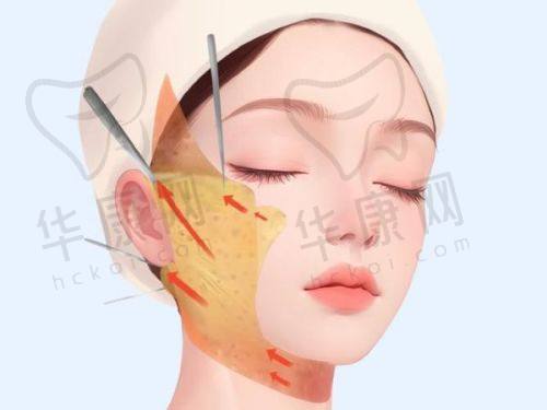 广东美恩整形美容医院