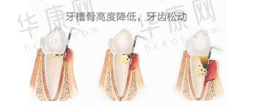 成都东篱医院整形外科的成功实例