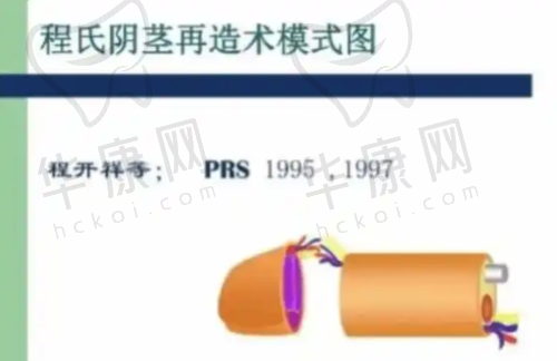 总结