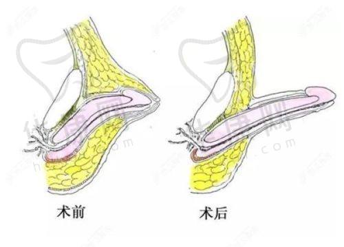 沈绍勇医生的口碑评价