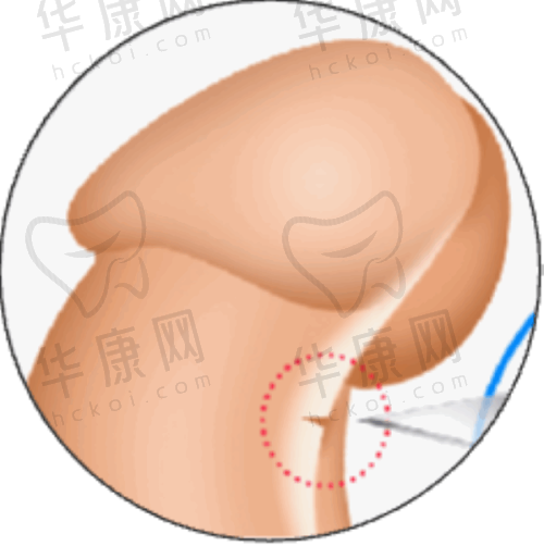 内江韩美整形医院的口碑评价