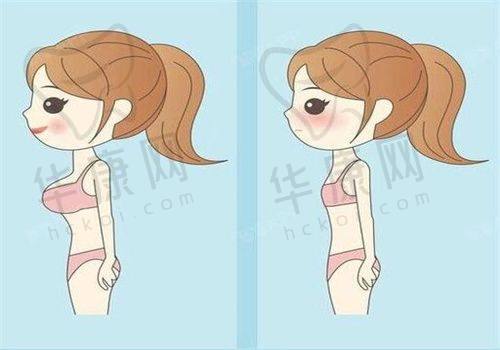 朱良平医生特色技术优势
