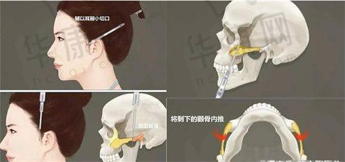中山美南华美容医院的口碑如何