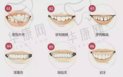 云南玉溪牙博仕口腔儿童早期矫正全周期24999元起，专业连锁助力孩子口腔健康