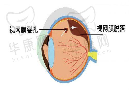 北京美尔目眼科医院为何值得选择