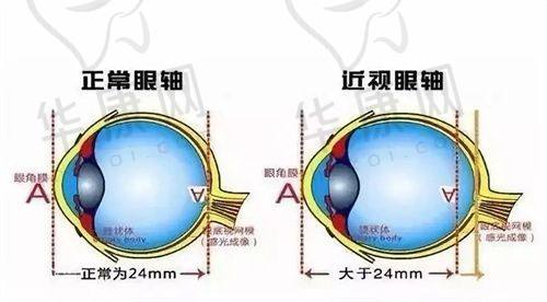 许昌华厦眼科医院的医生团队实力