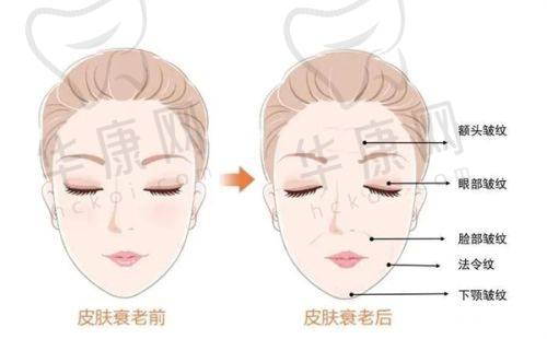 患者实例见证西安晶肤医疗美容半岛超声炮+光子嫩肤项目成效
