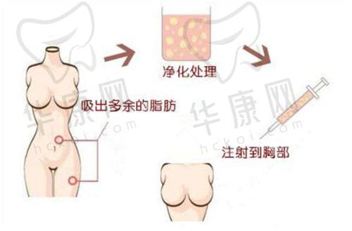 腹部吸脂术后皮肤出现松弛有什么改善方法?