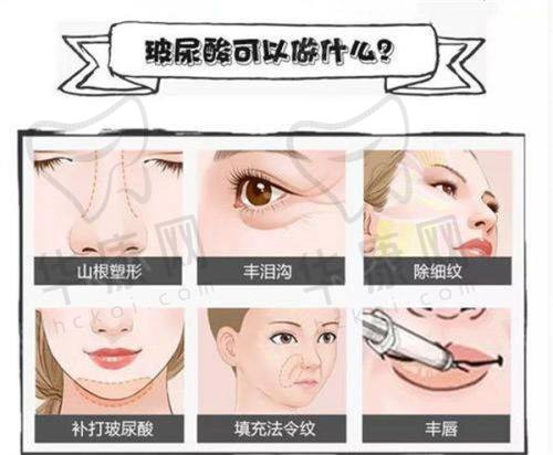北京蒂凡妮医疗美容郭栋医生特色技术优势