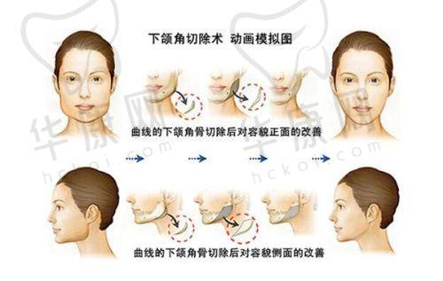 吴江山医生的技术优势