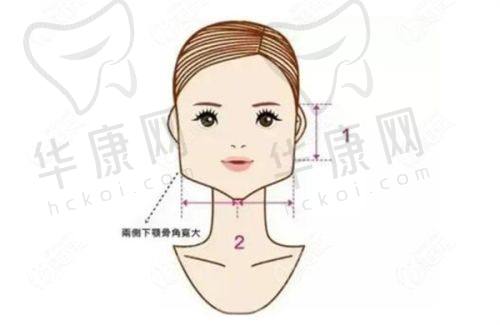成都高新怡脂医疗美容邓萌院长特色技术优势