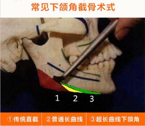 重庆当代整形医院周边有啥生活配套？能满足哪些需求？