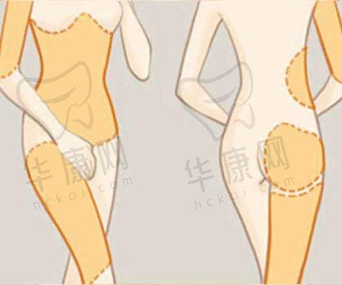 术后修复情况