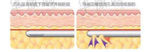 郑京湘医生特色技术优势