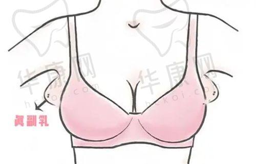 北京禾美嘉吸脂咋样啊？价格16800 - 59800元起，技术规范术后身材比例自然