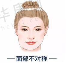 长沙美莱鼻部整形项目