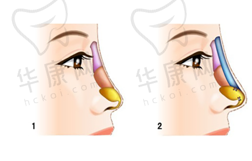 成都高新怡脂医疗美容刘芳医生预约方式