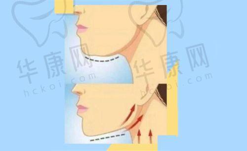 云南吴氏嘉美整形医院怎么样？40年连锁医美，荣誉多设施强价格合理值得选