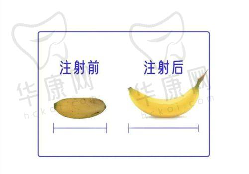 福州伽禾伽美医院的收费与口碑