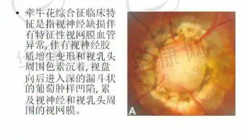 詹行楷医生特色技术优势