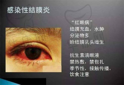 北京美尔目眼科医院预约挂号有哪些秘籍