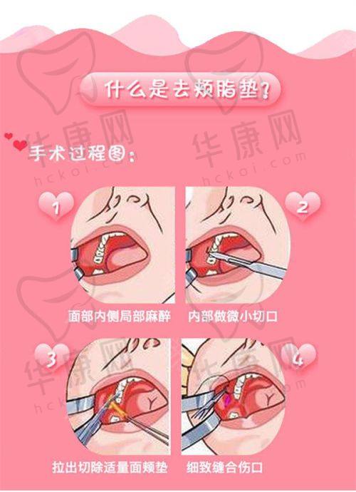 成都高新怡脂医疗美容邓萌院长预约方式