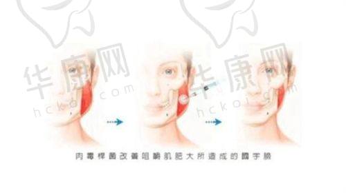 云南吴氏嘉美整形医院的医生团队实力如何？