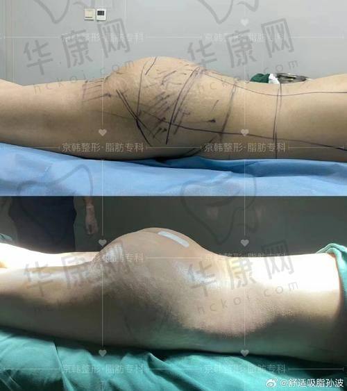 术前沟通与方案设计